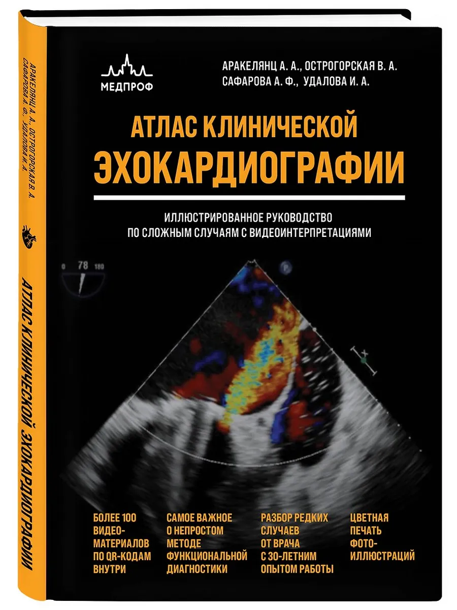 Атлас ЭхоКГ. Иллюстрированное руководство по сложным случаям с видеоинтерпретациями