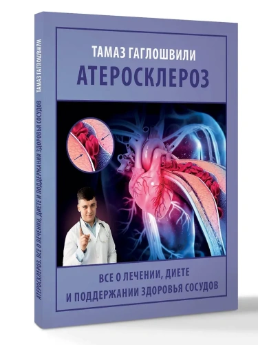 Атеросклероз. Все о лечении, диете и поддержании здоровья сосудов- купить в магазине Кассандра, фото, 9785171731861, 
